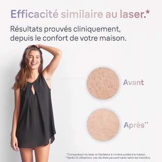 Epilateur lumière pulsée - Skin i-expert - Visage & corps