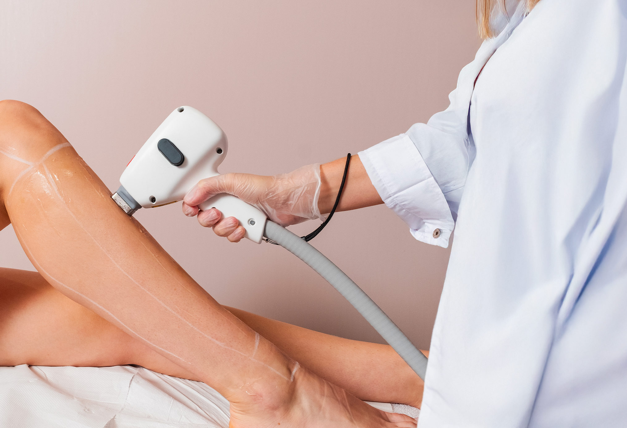 EPILATION LASER POUR TOUS à prix discount chez SHOWROOMPRIVÉ