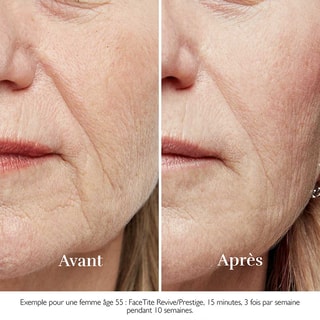 Appareil anti-âge - FaceTite Revive - Visage 