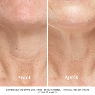 Appareil anti-âge - FaceTite Revive - Visage 