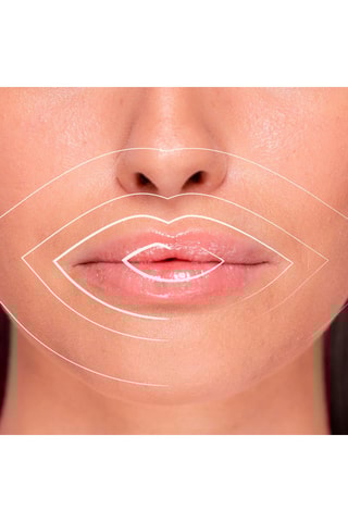 Repulpant pour lèvres à l'acide hyaluronique - Peaux sensibles - 5 ml