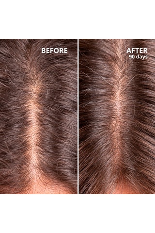 Traitement pour la croissance et la densité des cheveux - 50 ml