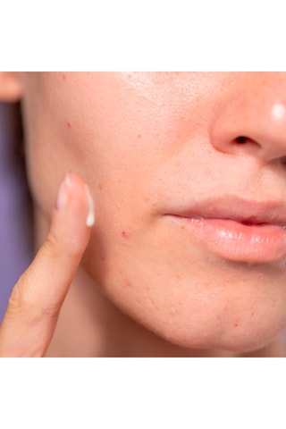 Soin visage éclatant à l'acide azélaïque - Peaux sensibles - 15 ml
