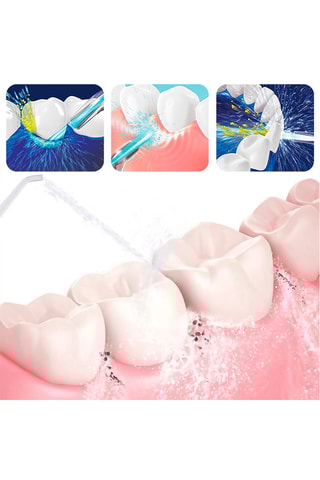 Irrigateur buccal à 4 têtes