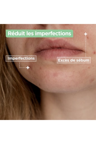 Nettoyant confort anti-imperfections - Peaux à imperfections - 200 ml