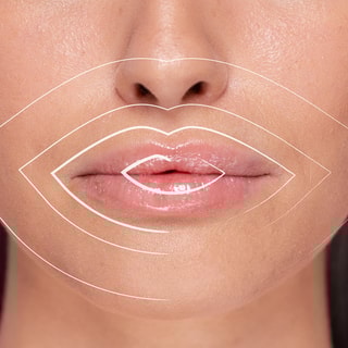 Gloss repulpant - Acide hyaluronique - 5 ml