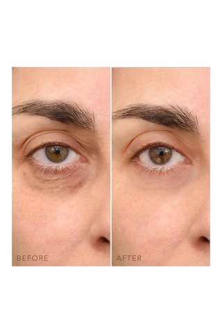 Oogcontourcrème C-Concentré Iris™ 15 ml