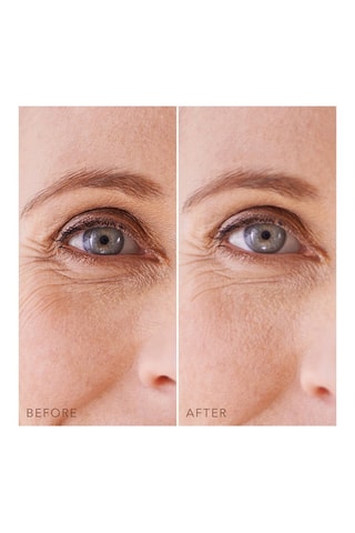 Oogmasker Hydrogel hydratant Iris™ 60 Patches