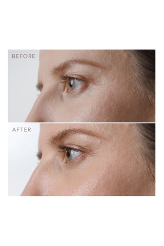 Verstevigend Oogserum Iris™ 15 ml