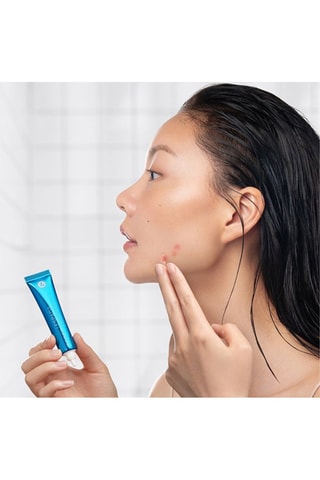 Anti-acne Gel Blemish Solution - Vette Huid - 15 ml