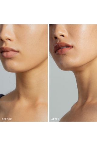 Gezichtstoningsrapparaat met Microstroom BEAR™ 2 Go