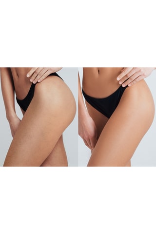 Epilator met Pulselicht PEACH™ 2 Pro Max