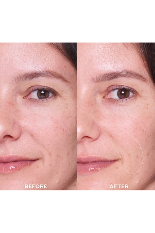 Masque visage Dewtopia 25% Acid Flash Facial - Tous types de peaux - 50 ml