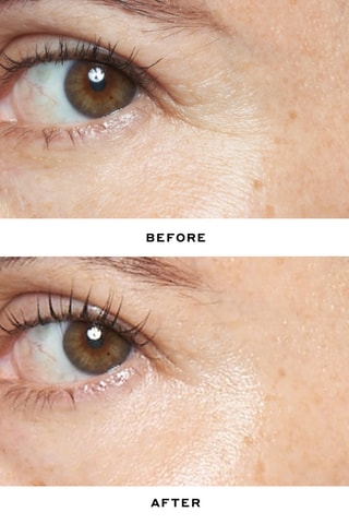 Sérum au rétinol Double RewindPro-Grade 0.3% - Tous types de peaux - 30 ml