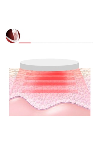 Ceinture faciale d'électrostimulation