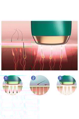 Épilateur à lumière pulsée T4 - Vert émeraude