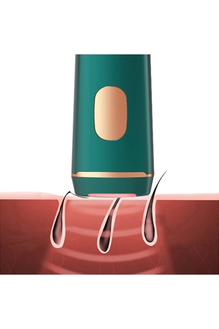 Epilateur à lumière pulsée - 
Vert