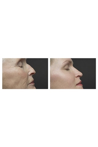 Instrument soin de la peau 4-en-1