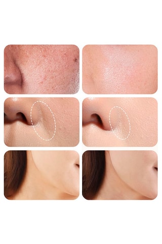 Appareil de massage pour le visage - Noir