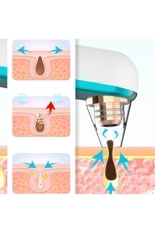 Extracteur de points noirs X9 - Bleu