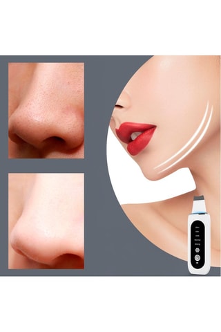 Epurateur de peau à ultrasons - Blanc