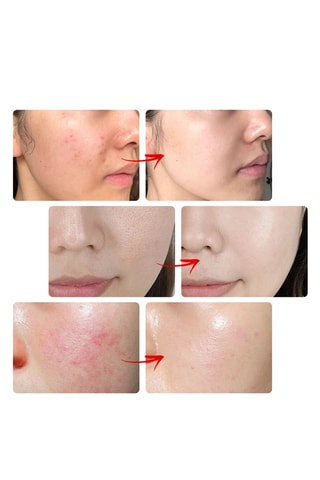 Masque soin du visage - Anti-âge