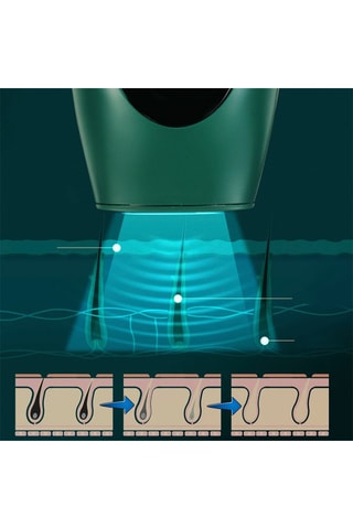 Épilateur à lumière pulsée - 36 W