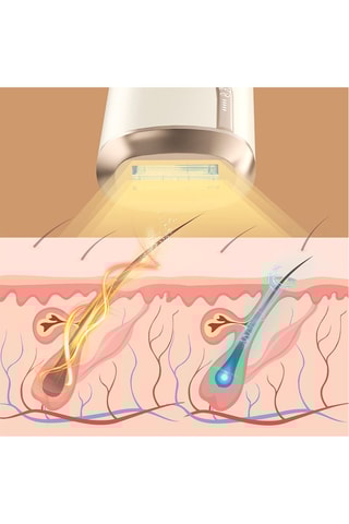 Epilateur laser électrique - Rose