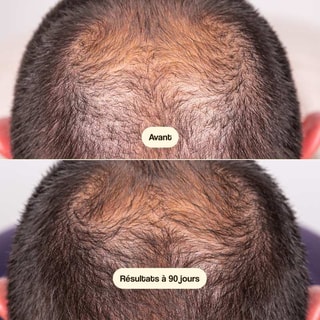 Soin anti-chute - Hair Growth & Density - Cheveux fragilisés - 50 ml