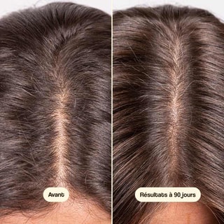 Soin anti-chute - Hair Growth & Density - Cheveux fragilisés - 50 ml