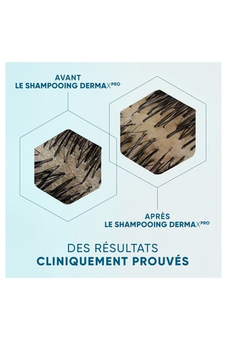 Shampoing apaisant Derma x Pro Shampoings - Cuirs chevelus qui démangent et qui sont déséquilibrés - 250 ml