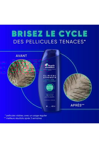 Shampoing anti-démangeaisons Head & Shoulders Force clinique - 400 ml