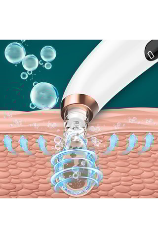 Estrattore di punti neri a piccole sfere X13 - Bianco