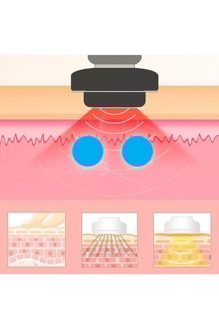 Apparecchio ringiovanimento Zeus - Rosso