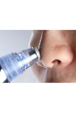 Apparecchio pulizia e aspiratore pelle