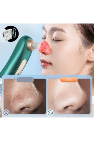 Apparecchio anti punti neri