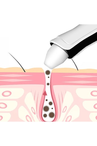 Aspiratore punti neri - Bianco