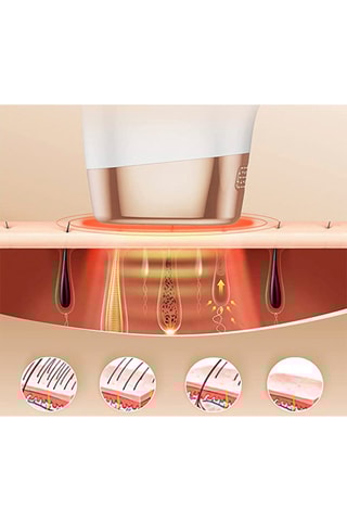 Epilatore a luce pulsata Ts8