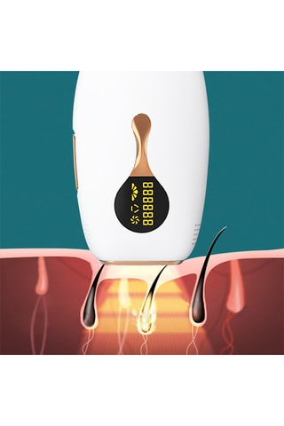 Epilatore a punto di congelamento