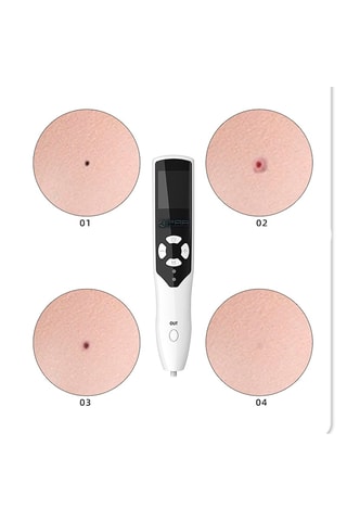 Penna multifunzione a ozono - 5 testine