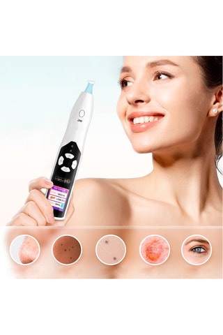 Penna multifunzione a ozono - 5 testine