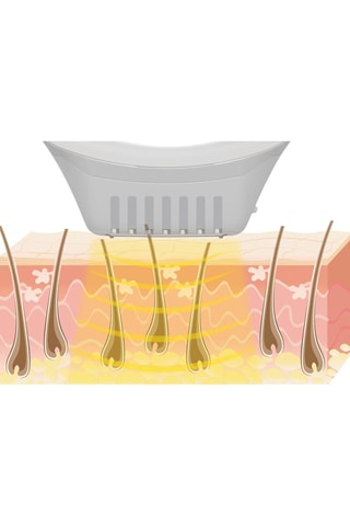 Epileerapparaat met Lichtflitsen