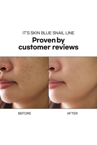 Siero Blue Snail - Tutti i tipi di pelle - 40 ml