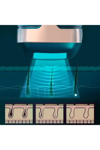 Epilatore a luce pulsata T58 - Blu