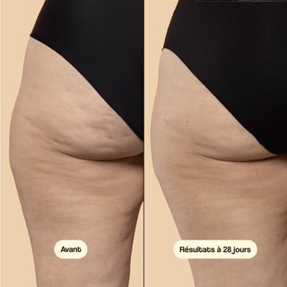 Crema anticellulite e rassodante - 50 ml