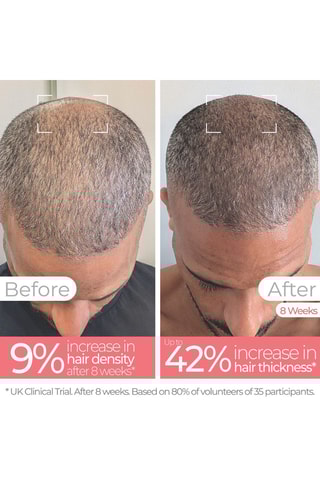 Brosse massante - Lumière rouge