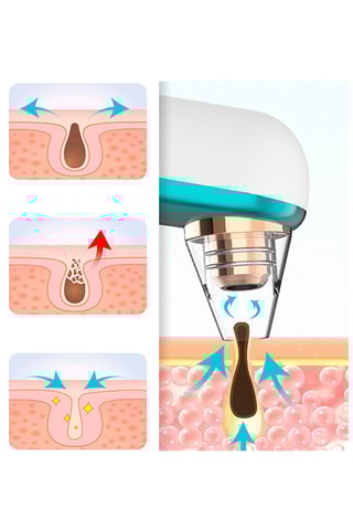 Estrattore di punti neri X9