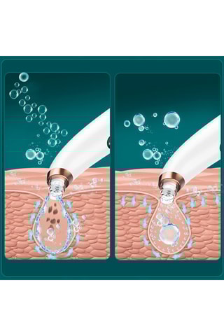 Estrattore di punti neri a piccole sfere X13 - Bianco