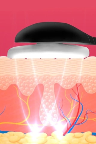 Apparecchio di elettrostimolazione facciale EMS