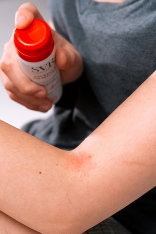 SOS Krabben Cicavit+ - Geschikt voor de Gevoelige Huid - 40 ml